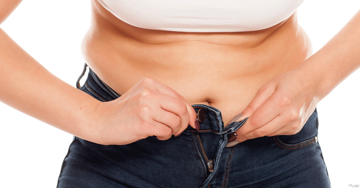 That Loose Tummy Skin Is Called a Panniculus—and Exercise Won't